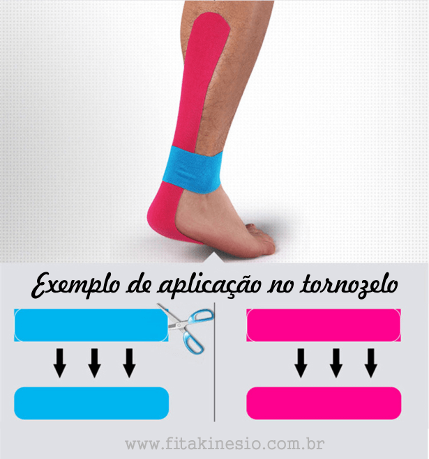 Exemplo de aplicação no tornozelo da bandagem terapêutica